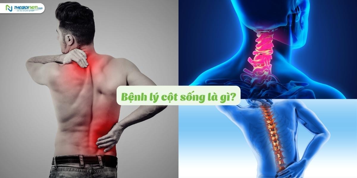Bật mí từ chuyên gia - Mách bạn các tư thế ngủ tốt cho cột sống