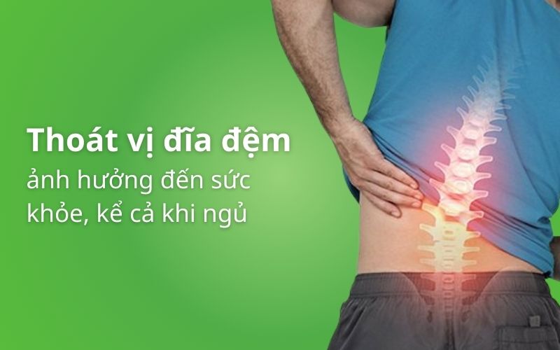 Bị thoát vị đĩa đệm gây đau nhức kể cả khi ngủ