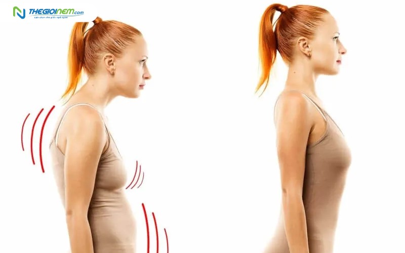 Dấu hiệu nhận biết bị cổ rùa