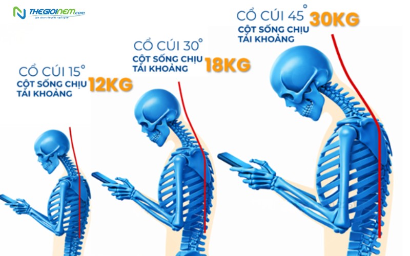 Nguyên nhân phổ biến dẫn đến bị cổ rùa