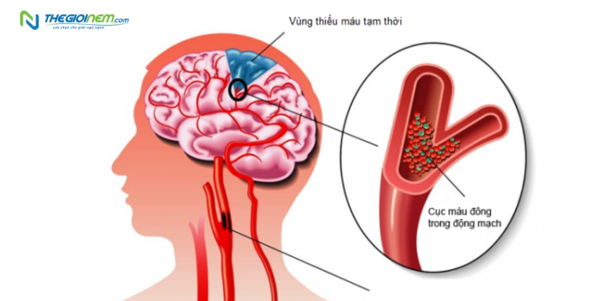 Ngủ gà ngủ gật là gì? 