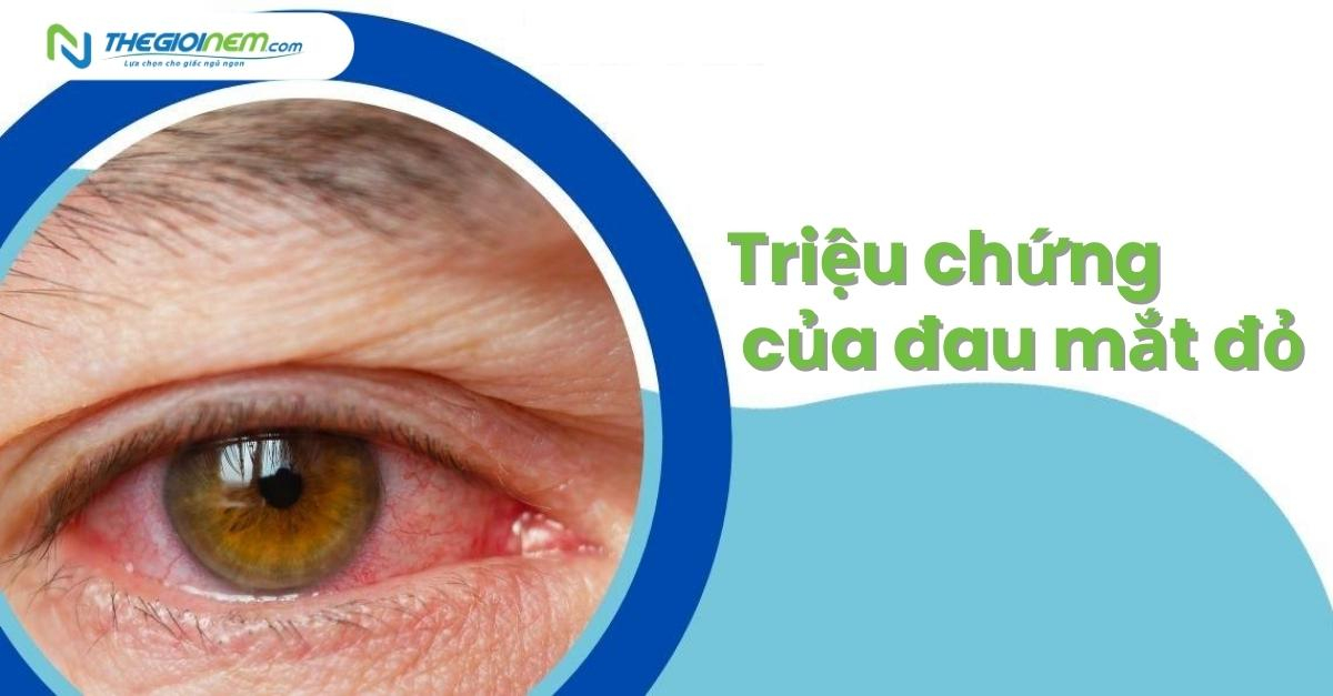Đau mắt đỏ là gì? nguyên nhân, triệu chứng và cách phòng ngừa