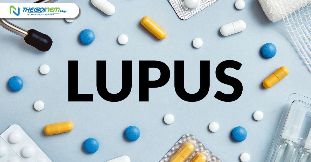 Bệnh Lupus ban đỏ là gì? Có chữa được không?