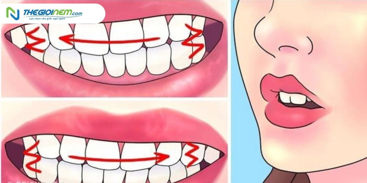 Cách điều trị tật nghiến răng khi ngủ 01| Thegioinem.com