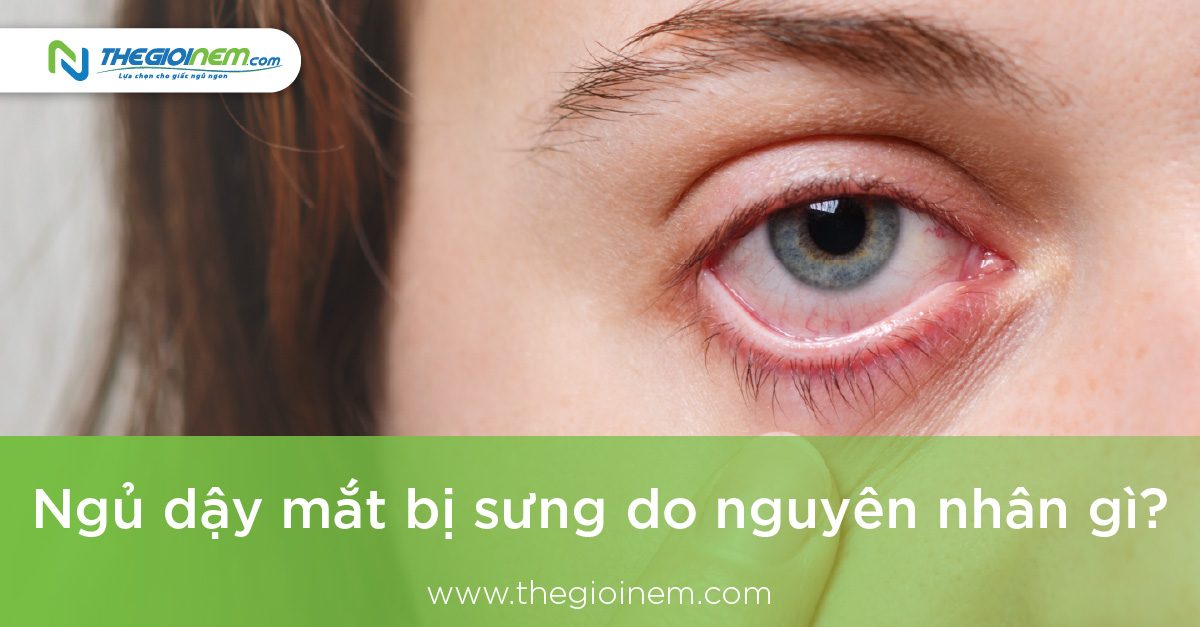 Ngủ dậy mắt bị sưng do nguyên nhân gì? 1
