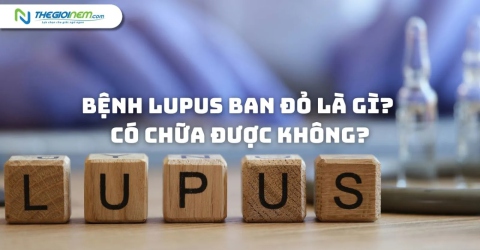 Bệnh Lupus ban đỏ là gì? Có chữa được không?