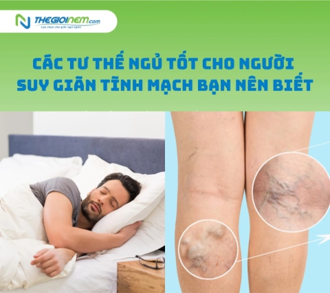 Các tư thế ngủ tốt cho người suy giãn tĩnh mạch bạn nên biết